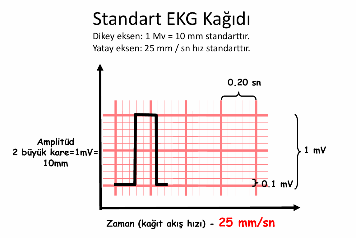 EKG Resim1